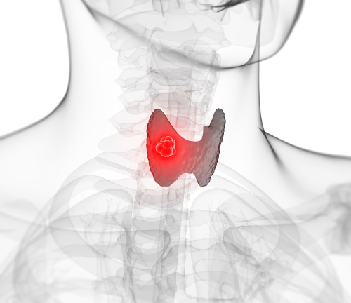 thyroid issues and MCAS