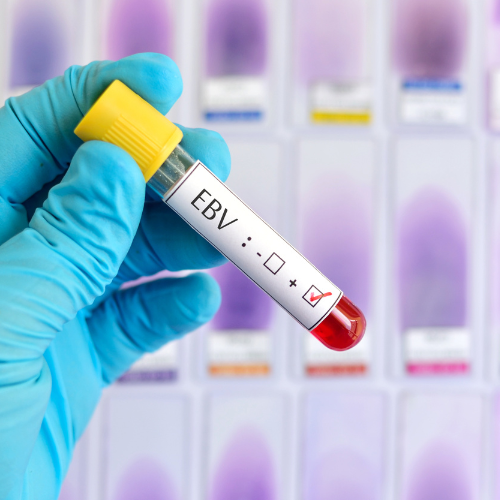 The Connection Between EBV and MCAS